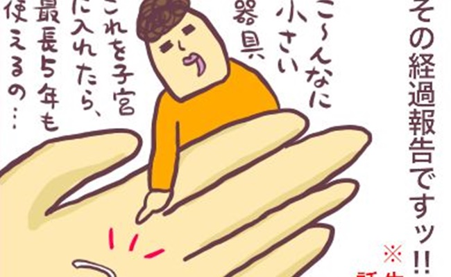 ミレーナ体験談
