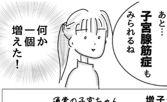 子宮内膜症入院＃4