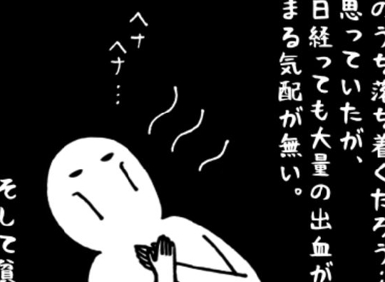 「次から次へと！」展開多すぎ！老化現象かと思っていたら…／卵巣嚢腫日記。#2