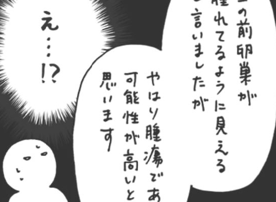 「腫瘍！？」悪い病気ってこと！？今まで気にならなかったのに…／卵巣嚢腫日記。#4