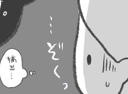 「卵巣摘出！？」強烈な痛みの原因は？医師の言葉に震えた／卵巣のう腫が消えた#8