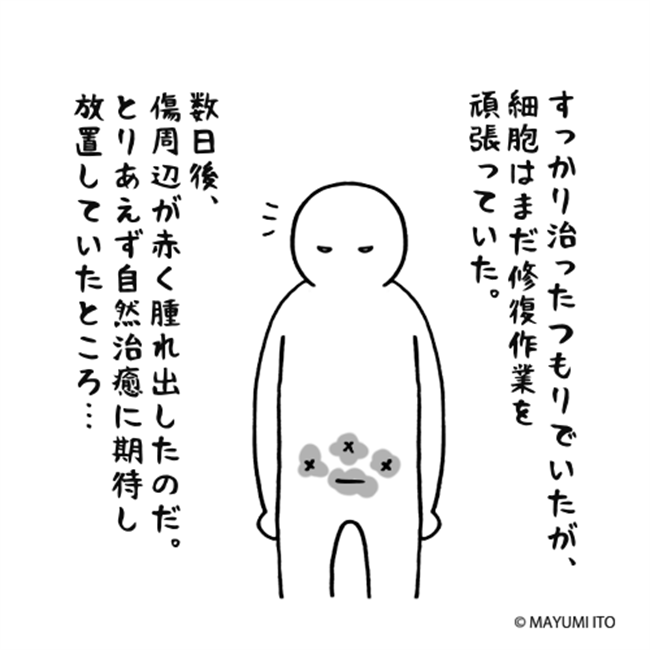 「ん？腫れてる？」経過は良好だったのに…まさかのトラブル！／卵巣嚢腫日記。#35