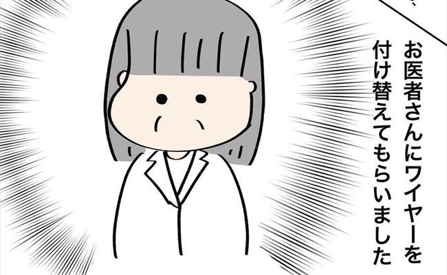 「ぎゃぁあ〜！」はじめてのワイヤー調整日。未体験の痛みに思わず… #歯列矯正はじめました 15